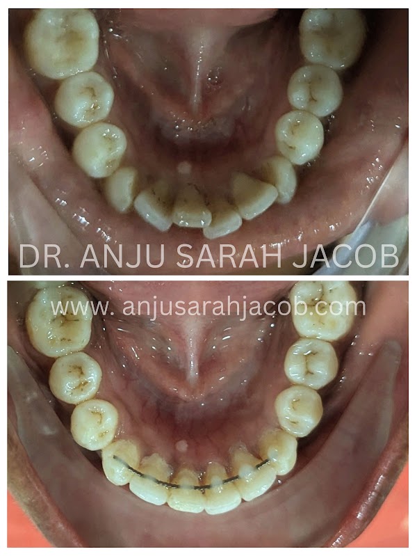 Case 06, view 5 of 9