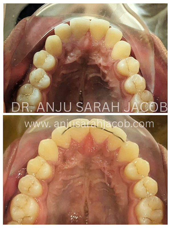 Case 12, view 4 of 9