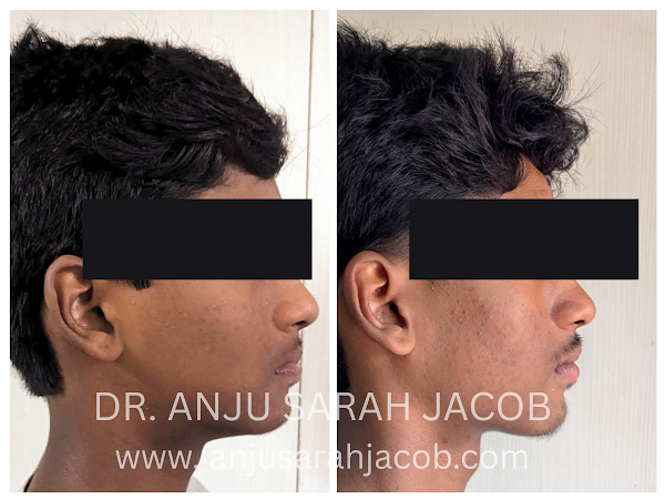 Case 07, view 7 of 9