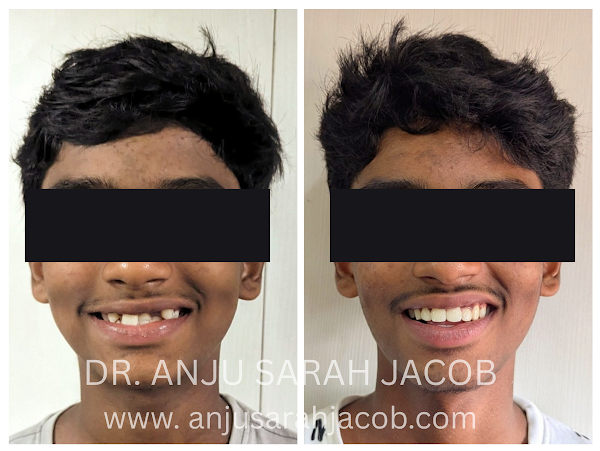 Case 07, view 9 of 9