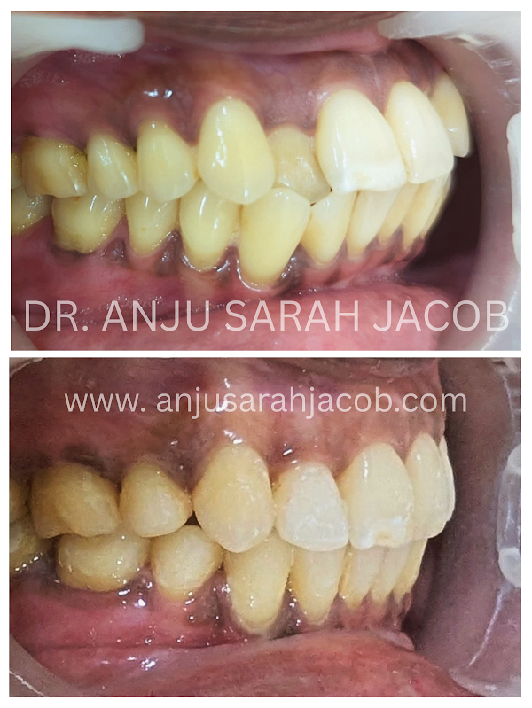 Case 05, view 2 of 9