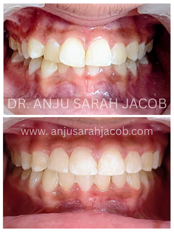 Case 09, view 1 of 9