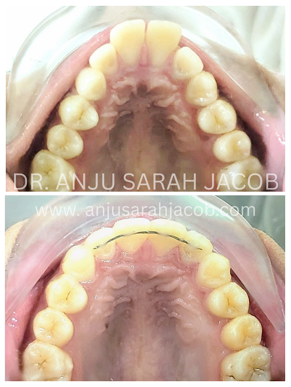 Case 03, view 4 of 9