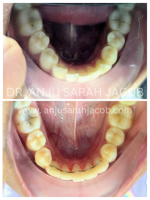 Case 03, view 5 of 9