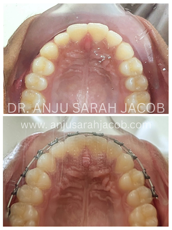 Case 08, view 4 of 9