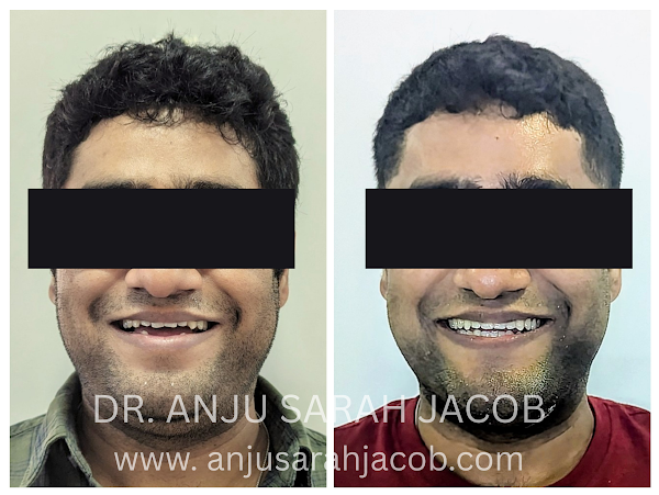 Case 02, view 9 of 9